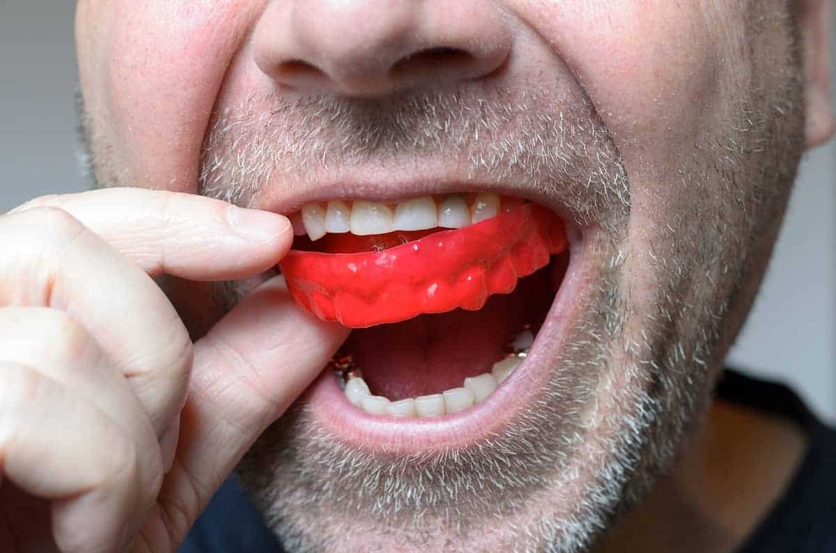 how does a mouth guard protect your teeth