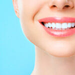 teeth whitening 5 reasons to consider it