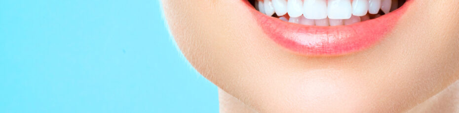 teeth whitening 5 reasons to consider it