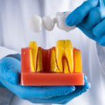a guide to different types of dental bridges