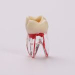Root Canal vs. Extraction: Why Saving Your Tooth Matters