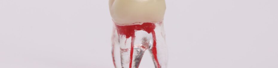 Root Canal vs. Extraction: Why Saving Your Tooth Matters