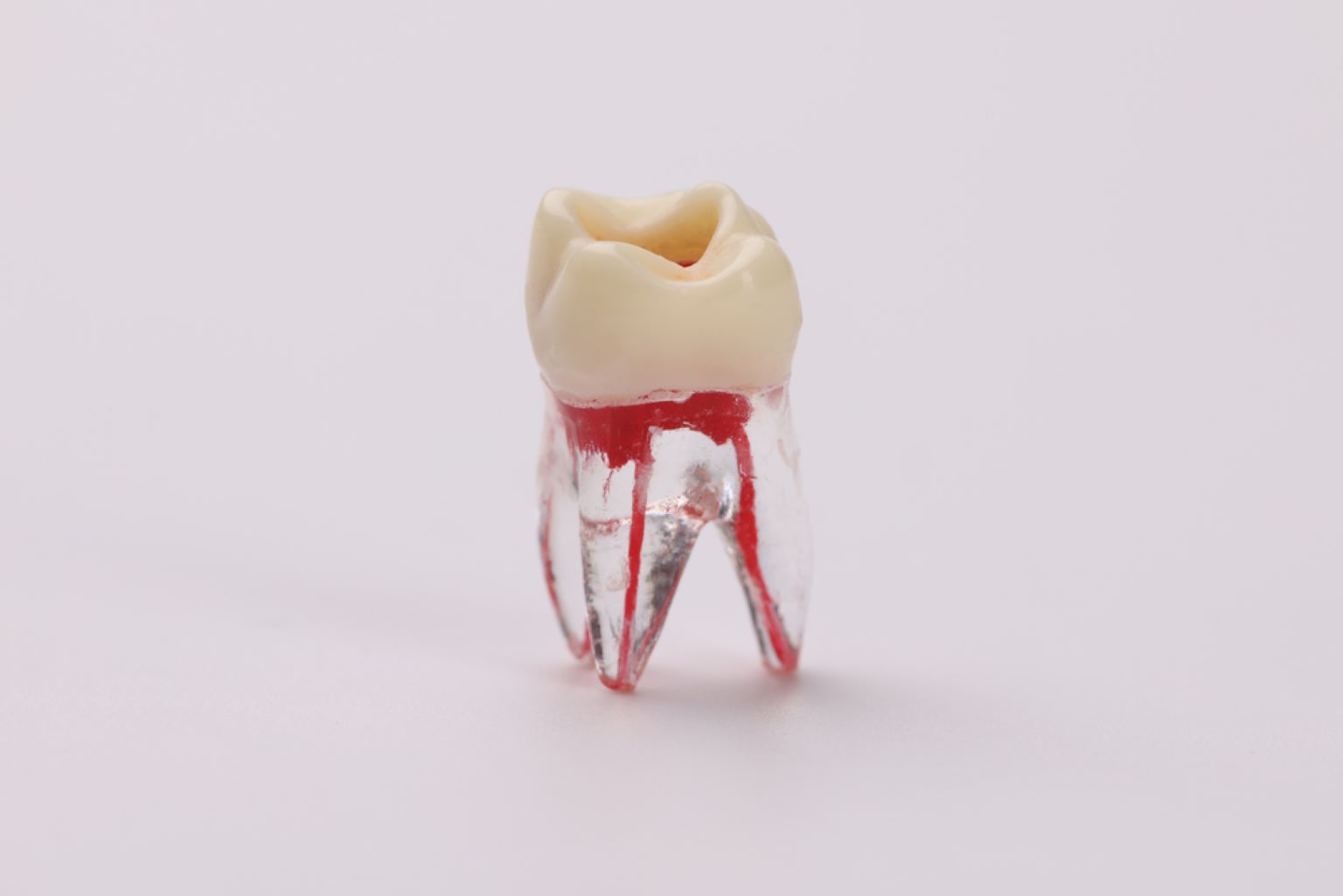 Root Canal vs. Extraction: Why Saving Your Tooth Matters