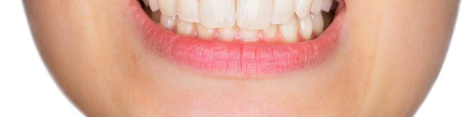 Can Bleeding Gums Go Away on Their Own? What You Need to Know