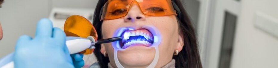 Is Teeth Whitening Safe? Myths and Facts Explained