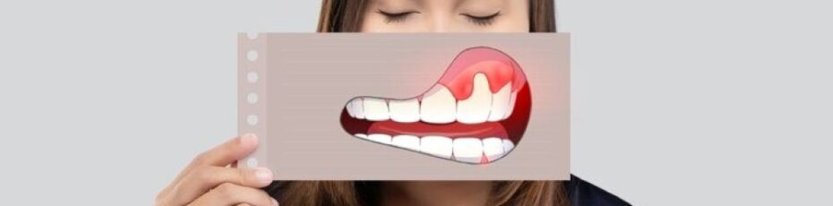 Non-Surgical Gum Treatment Options Explained