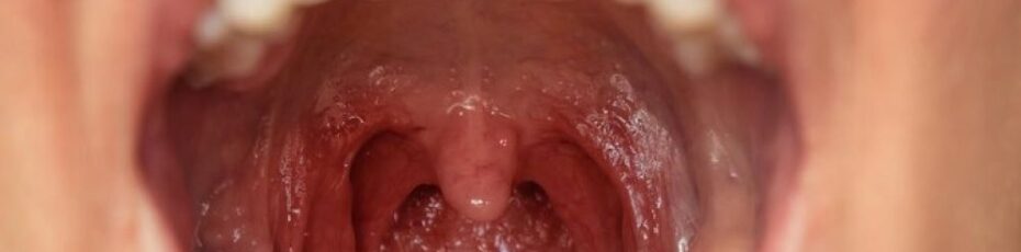 Why Early Oral Cancer Screening Matters