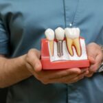 Step-by-Step Dental Implant Procedure: From Consultation to Final Crown
