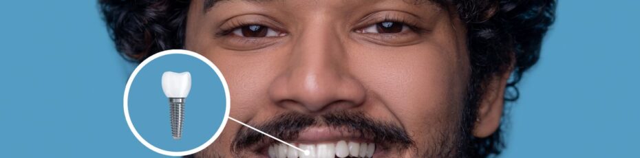 Dental Implant Cost in 2026: What Influences Price & Is It Worth It?