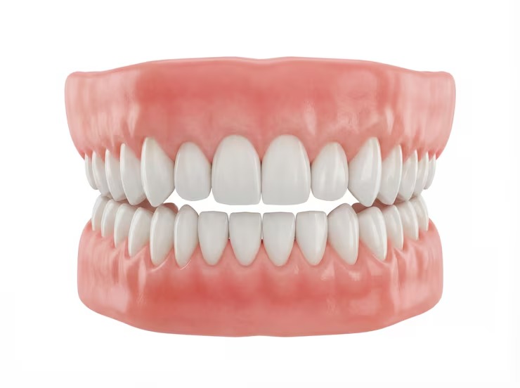 denture for restoring oral function after tooth loss.