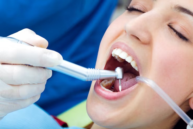 Frequent cavities heres how dental sealants can help